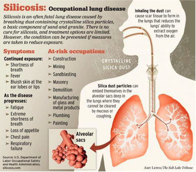 Silicosis_graphic - The Clean Air Coalition of W.N.Y.